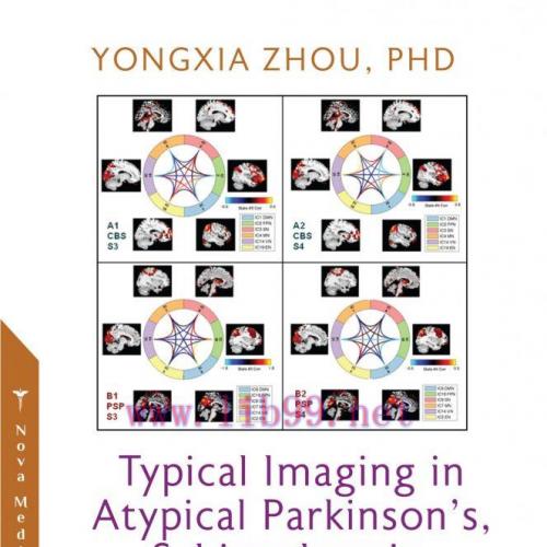 [AME]Typical Imaging in Atypical Parkinson’s, Schizophrenia, Epilepsy and Asymptomatic Alzheime...