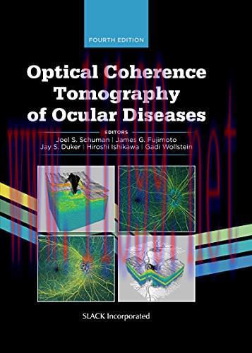 [AME]Optical Coherence Tomography of Ocular Diseases, 4th Edition (Original PDF)