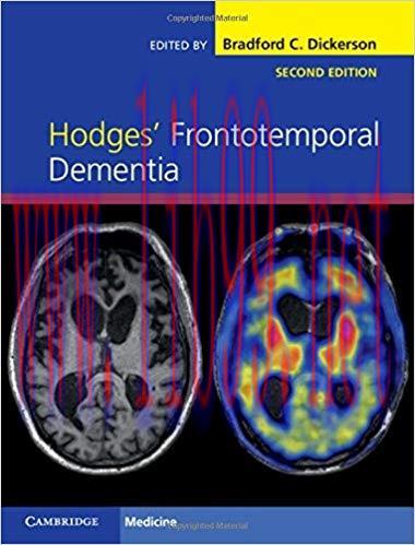 [PDF]Hodges&rsquo; Frontotemporal Dementia, Second Edition