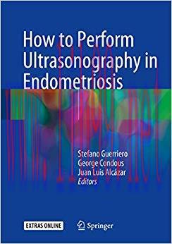 (PDF)How to Perform Ultrasonography in Endometriosis 1st ed. 2018 Edition