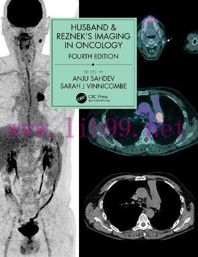 [AME]Husband & Reznek&rsquo;s Imaging in Oncology, 4th edition (ePub)