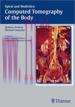 [AME]Spiral and Multislice Computed Tomography of the Body