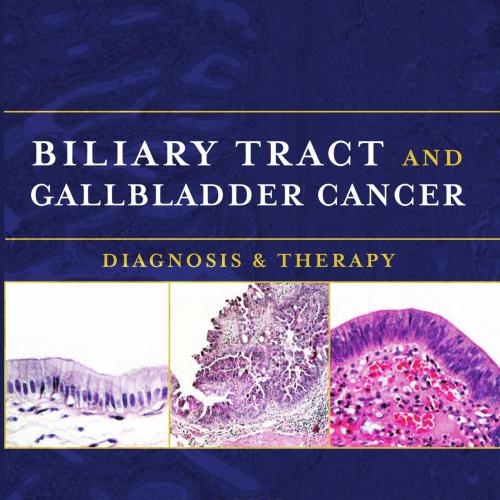Biliary Tract and Gallbladder Cancer-Diagnosis and Therapy - Thomas, Charles R.; Fuller, Clifto...