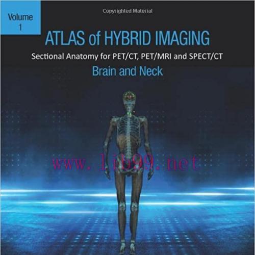 [PDF]Atlas of Hybrid Imaging Sectional Anatomy for PET CT, PET MRI and SPECT CT 3 Volume Set