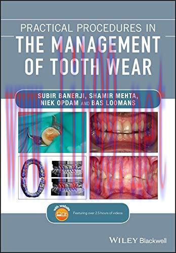 [PDF]Practical Procedures in the Management of Tooth Wear