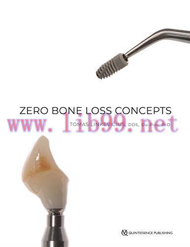 [AME]Zero Bone Loss Concepts