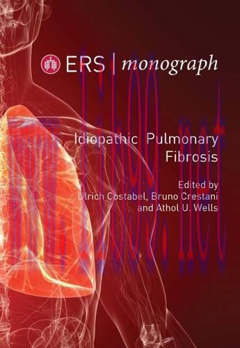 [AME]Idiopathic Pulmonary Fibrosis (ERS Monograph 71)