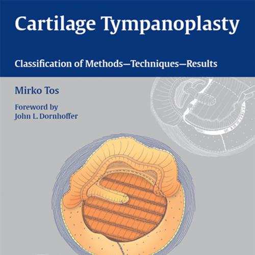 Cartilage Tympanoplasty