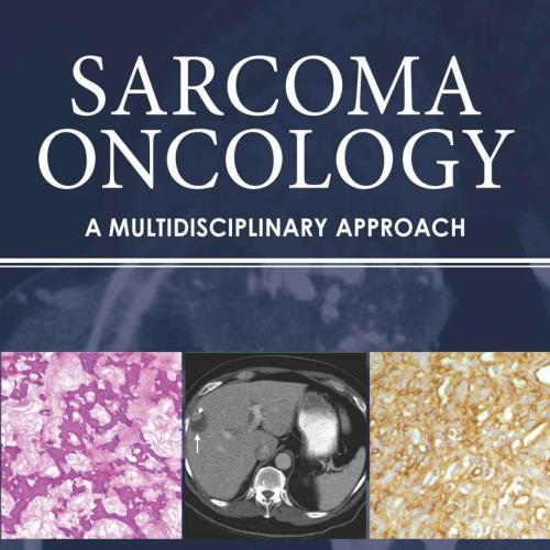 Sarcoma Oncology_ A Multidisciplinary Approach