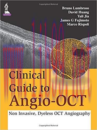 [PDF]Clinical Guide to Angio-OCT Non Invasive, Dyeless OCT Angiography