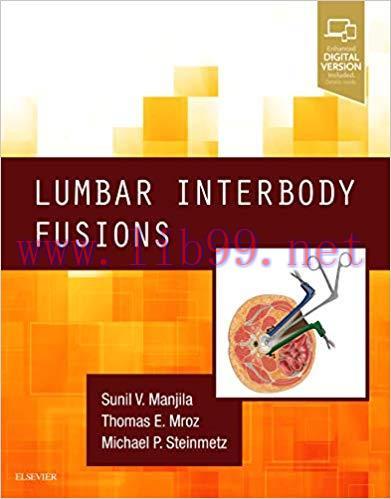 [PDF]Lumbar Interbody Fusions
