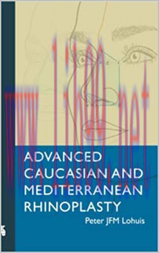 [EPUB]Advanced Caucasian and Mediterranean Rhinoplasty