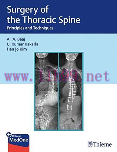 [AME]Surgery of the Thoracic Spine: Principles and Techniques (PDF)