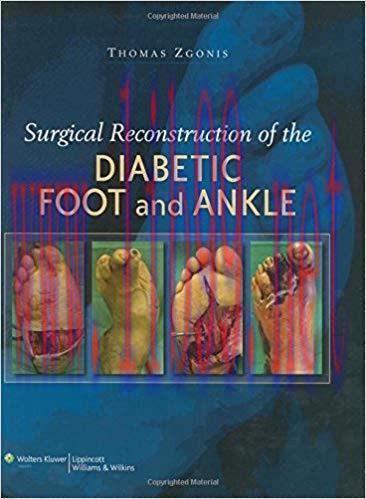 [PDF]Surgical Reconstruction of the Diabetic Foot and Ankle+CHM版