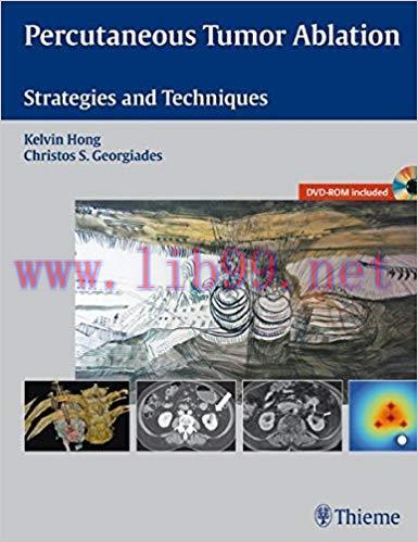 [PDF]Percutaneous Tumor Ablation + Videos