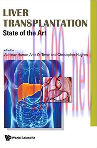 [AME]Liver Transplantation: State of the Art (Original PDF)