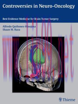 [AME]Controversies in Neuro-Oncology: Best Evidence Medicine for Brain Tumor Surgery (ORIGINAL ...