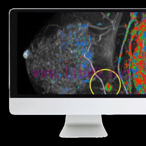 [AME]Breast Imaging Pearls and Pitfalls: Traditional and Novel Imaging Approaches 2020 (CME VID...