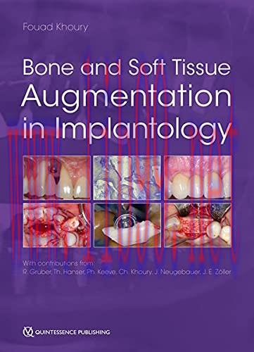 Bone and Soft Tissue Augmentation in Implantology (ePub+Converted PDF)