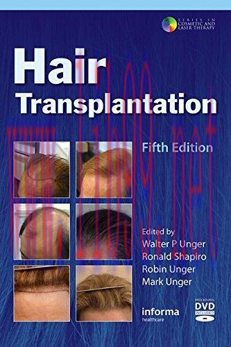[AME]Hair Transplantation, 5ed (Original PDF + Videos)