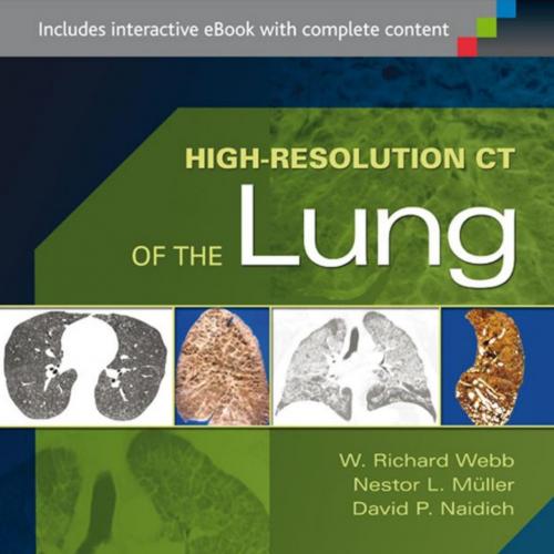 High-Resolution CT of the Lung, 5th Edition