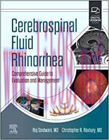 [AME]Cerebrospinal Fluid Rhinorrhea: Comprehensive Guide to Evaluation and Management (Original...
