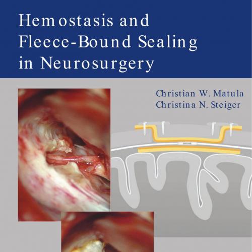 Hemostasis and Fleece-Bound Sealing in Neurosurgery