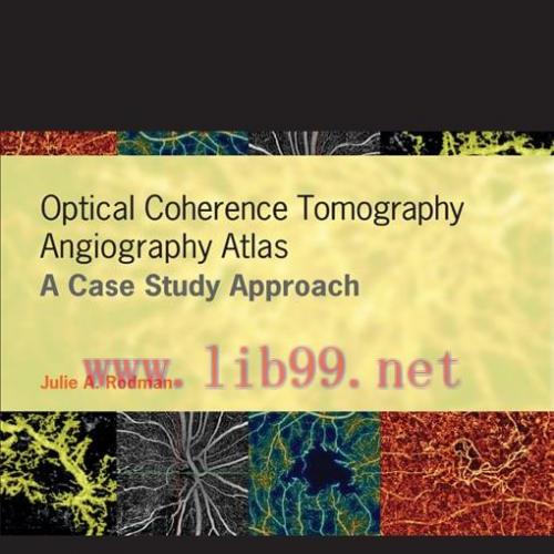 [AME]Optical Coherence Tomography Angiography Atlas (EPUB)