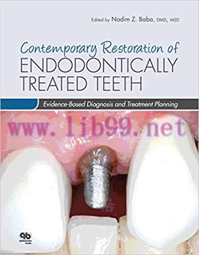 [AME]Contemporary Restoration of Endodontically Treated Teeth: Evidence-Based Diagnosis and Tre...