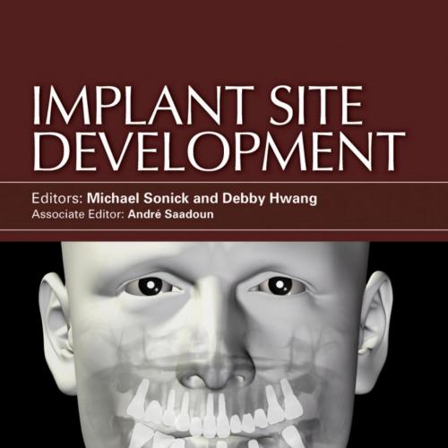Implant Site Development