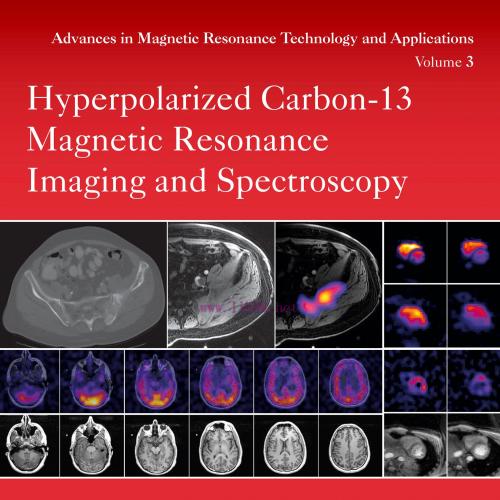 [AME]Hyperpolarized Carbon-13 Magnetic Resonance Imaging and Spectroscopy (Original PDF)