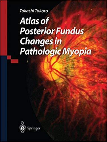 Atlas of Posterior Fundus Changes in Pathologic Myopia + EPUB