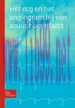 [PDF]Het ecg en het angiogram bij een acuut hartinfarct