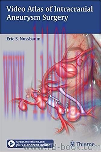 Video Atlas of Intracranial Aneurysm Surgery 1st Edition by Eric Nussbaum