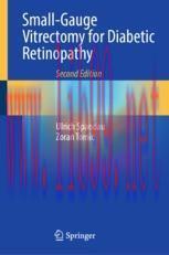 [PDF]Small-Gauge Vitrectomy for Diabetic Retinopathy