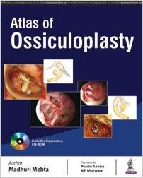 Atlas of Ossiculoplasty