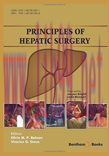 [AME]Principles of Hepatic Surgery (PDF)