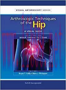 [PDF]Arthroscopic Techniques of the Hip