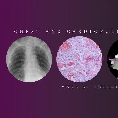 [AME]Chest and Cardiopulmonary Imaging &ndash; Marc V. Gosselin, M.D (Videos + PDF)