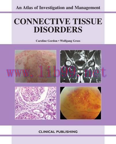 [AME]Connective Tissue Disorders: An Atlas of Investigation and Management (Original PDF)