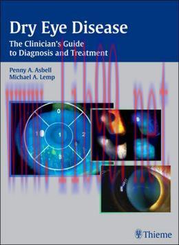 [AME]Dry Eye Disease: The Clinician's Guide to Diagnosis and Treatment