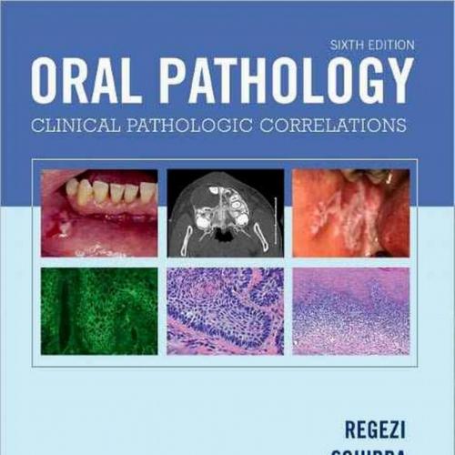 Oral Pathology-Clinical Pathologic Correlations, 6e