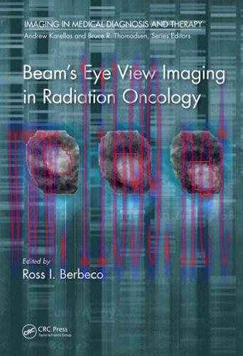 [AME]Beam's Eye View Imaging in Radiation Oncology (EPUB)