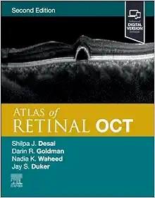 [AME]Atlas of Retinal OCT: Optical Coherence Tomography, 2nd Edition (True PDF from_ Publisher)