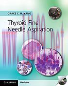 [AME]Thyroid Fine Needle Aspiration (Original PDF)