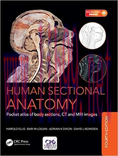 (PDF)Human Sectional Anatomy: Pocket atlas of body sections, CT and MRI images, Fourth edition ...