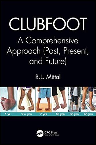 Clubfoot A Comprehensive Approach