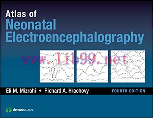 [PDF]Atlas of Neonatal Electroencephalography, Fourth Edition