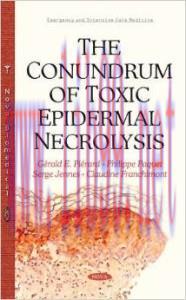 [AME]The Conundrum of Toxic Epidermal Necrolysis