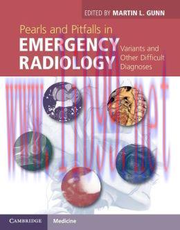 [AME]Pearls and Pitfalls in Emergency Radiology: Variants and Other Difficult Diagnoses